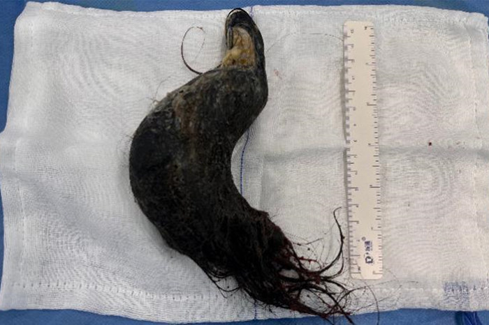ȡθʯһöθ״15cm_.jpg